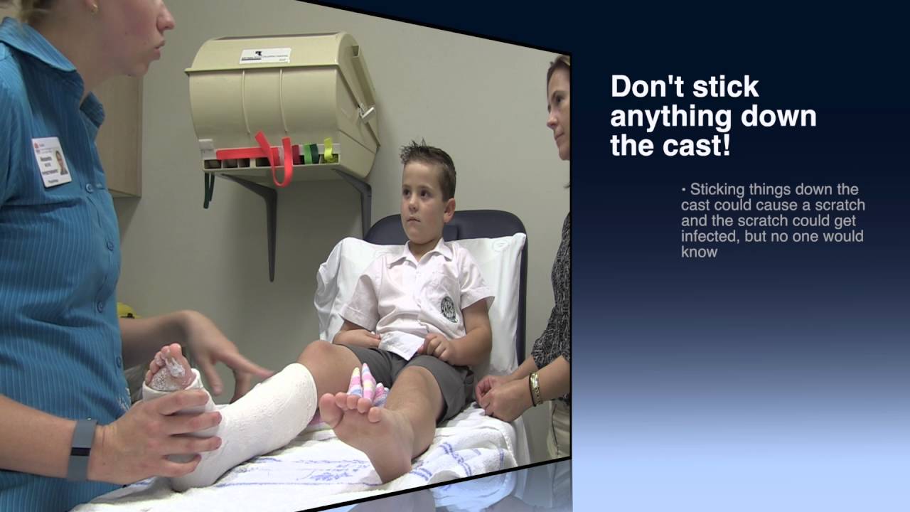 Plaster care - looking after your child's cast