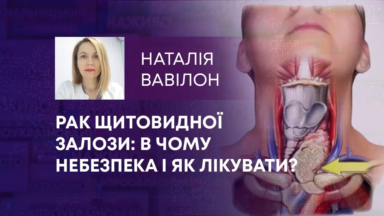 ТВ7+. РАК ЩИТОВИДНОЇ ЗАЛОЗИ: В ЧОМУ НЕБЕЗПЕКА І ЯК ЛІКУВАТИ?