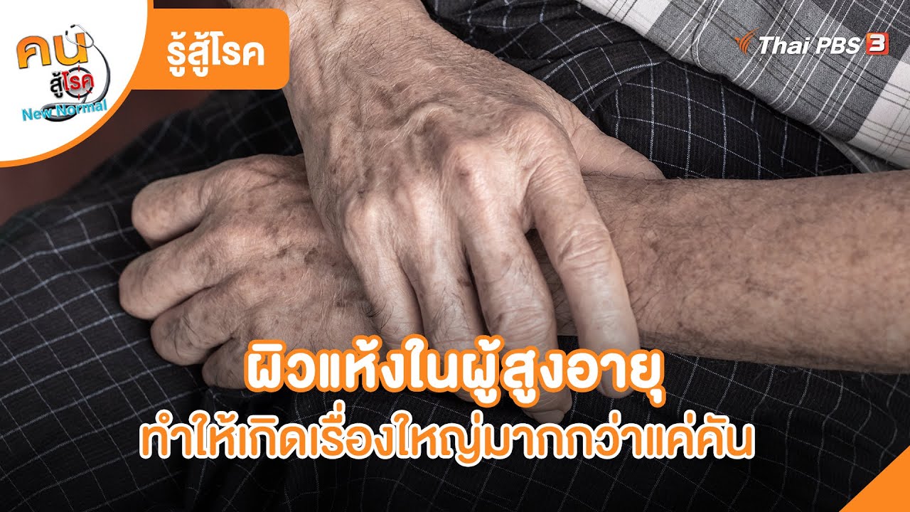 ผิวแห้งในผู้สูงอายุ ทำให้เกิดเรื่องใหญ่มากกว่าแค่คัน | รู้สู้โรค | คนสู้โรค
