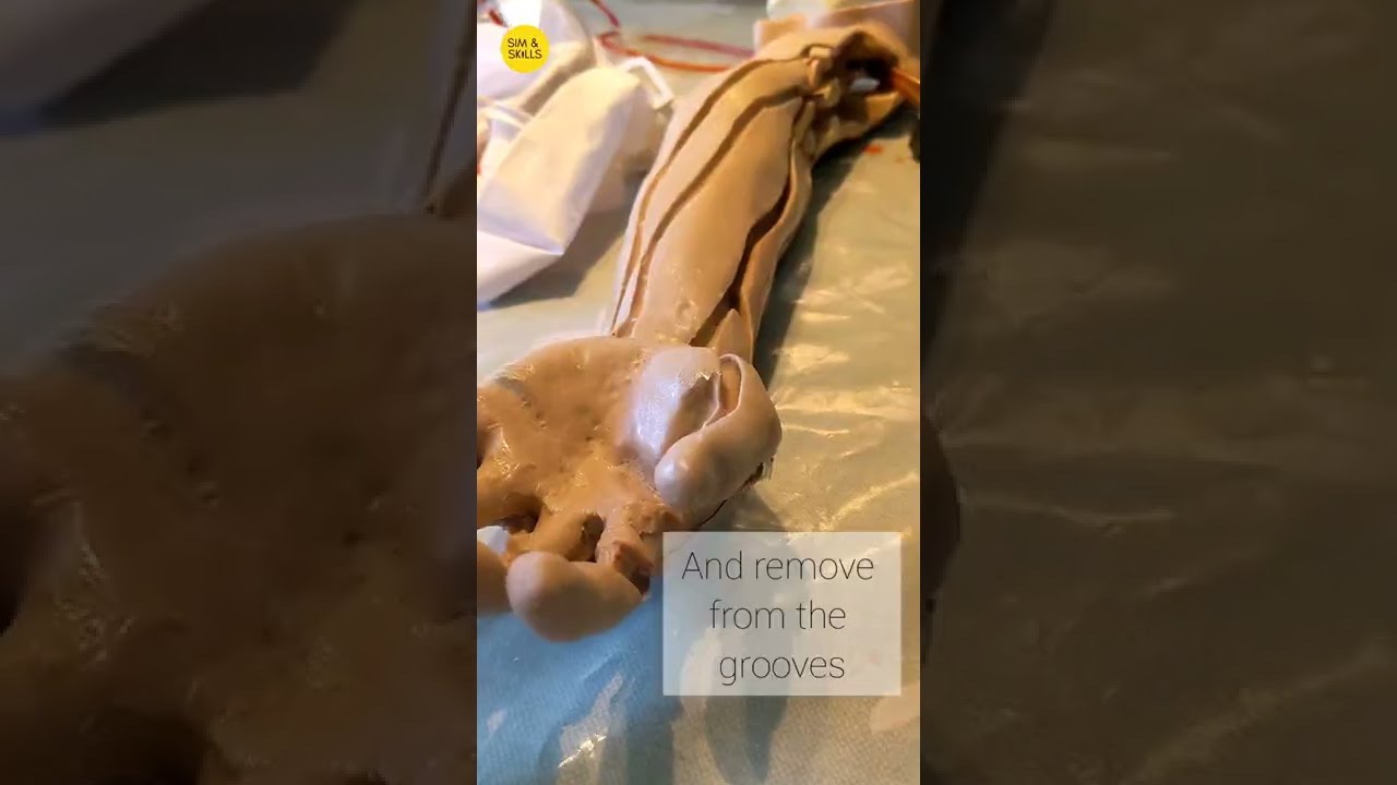 Replacing Skin and Veins on the Advanced Venepuncture and IV Injection Arm
