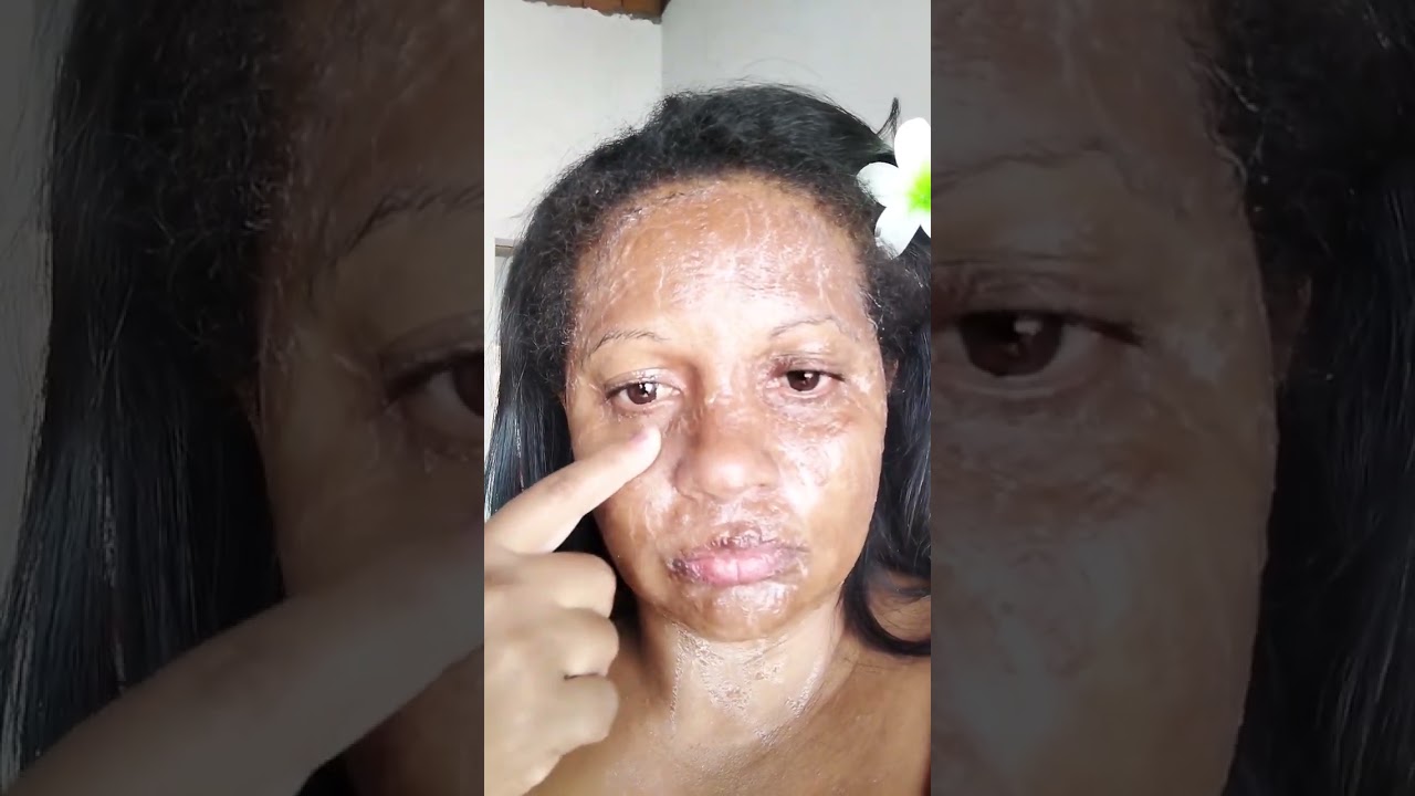 Com menos de 1 Real descobrir o segredo dos artistas incrível Botox caseiro 🤔!