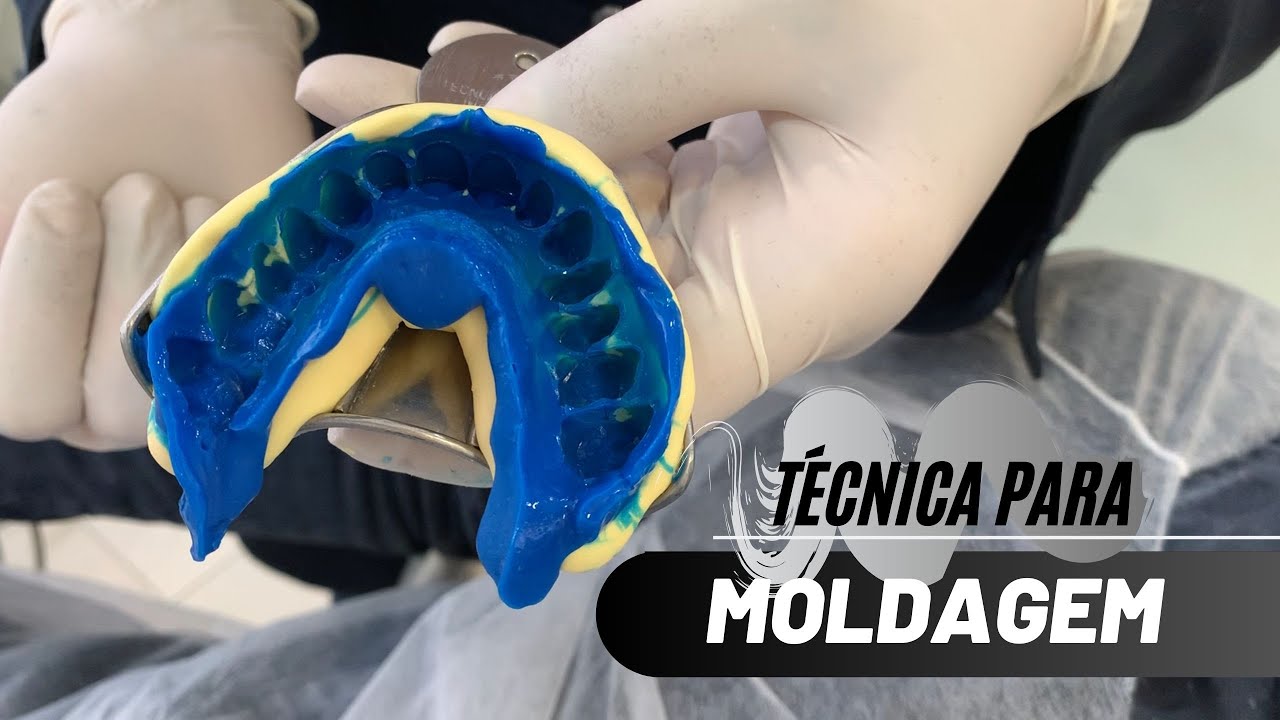 Moldagem! Como Realizo