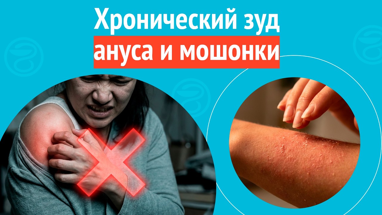 ➡️ Хронический зуд ануса и мошонки. Клинический случай № 1731