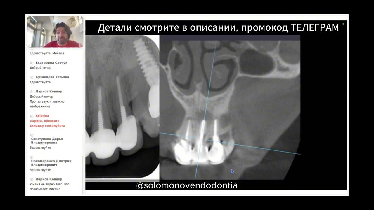 Важные ньансы в оценке КЛКТ. Доктор Соломонов