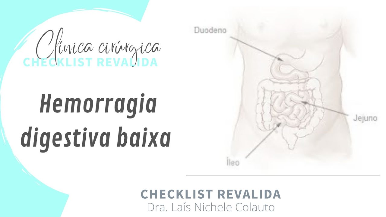 CHECKLIST: Hemorragia digestiva baixa por doença diverticular e angiodisplasia ( Revalida INEP)