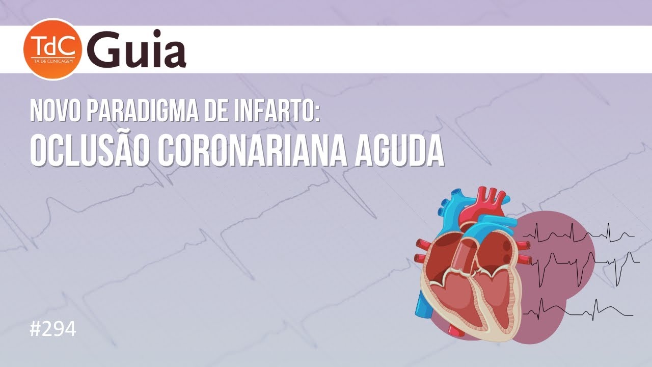 Epis&oacute;dio 294: Oclus&atilde;o Coronariana Aguda