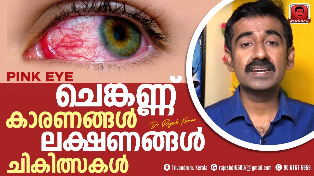 Conjunctivitis (Pinkeye) Causes, Symptoms, and Treatments