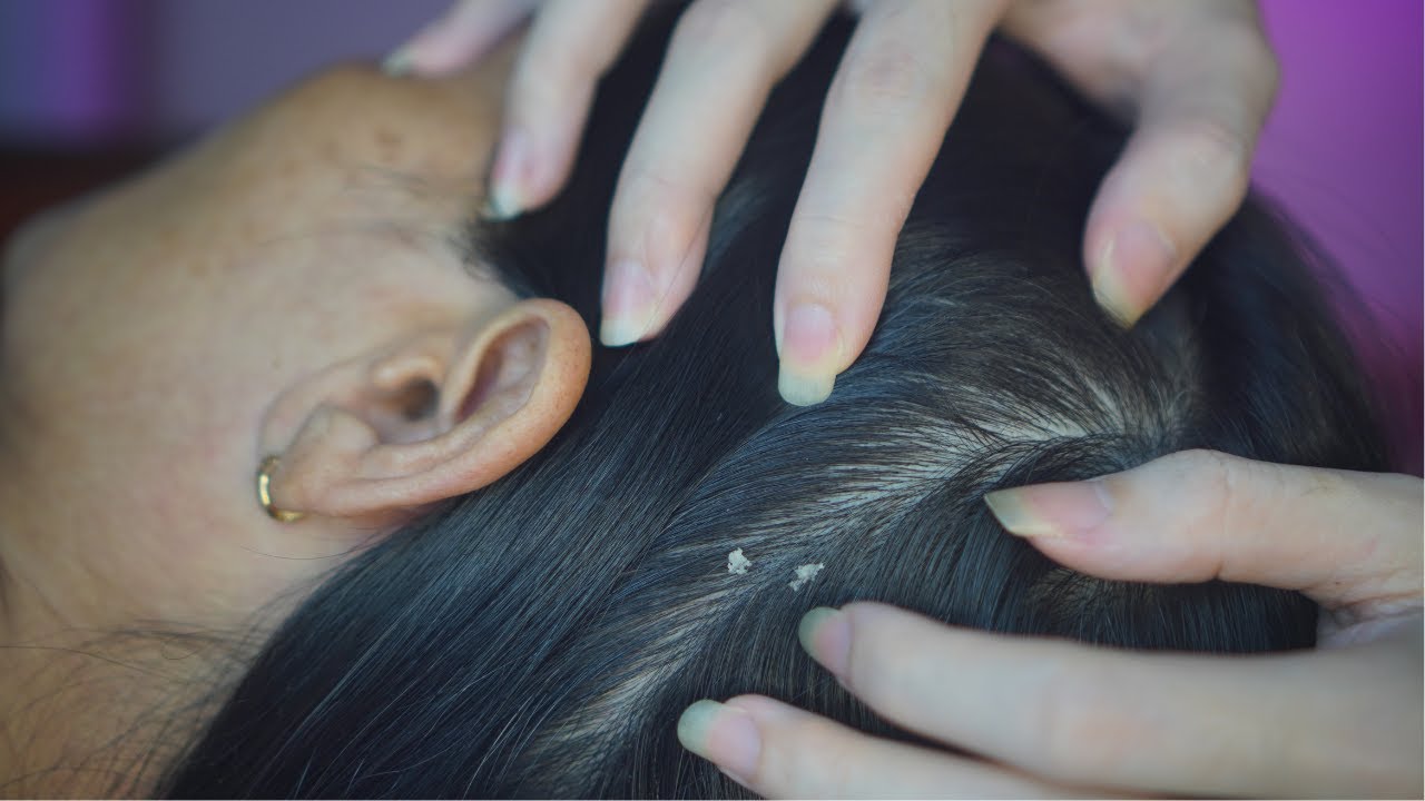 ASMR Scalp Cleaning, Gentle Scalp Massage & Scratching For Unwind ( Quiet )