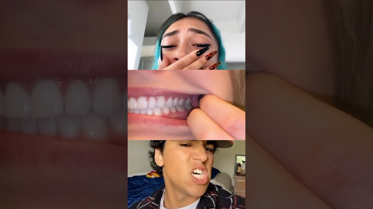 Ваш прикус идеален? 🦷 Вот как это определить