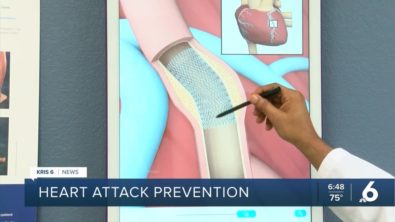 Heart Attack Prevention
