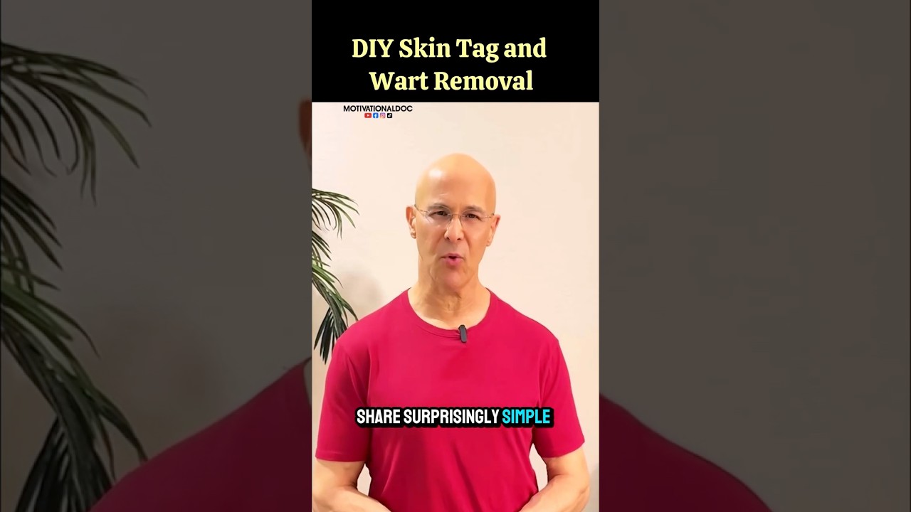 Usuwanie narośli sk&oacute;rnych i brodawek &ndash; domowe sposoby! #drmandell #narośl sk&oacute;rna #brodawka #zdrowie