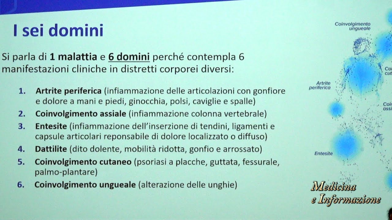 Artrite Psoriasica: le novità terapeutiche con le small molecules