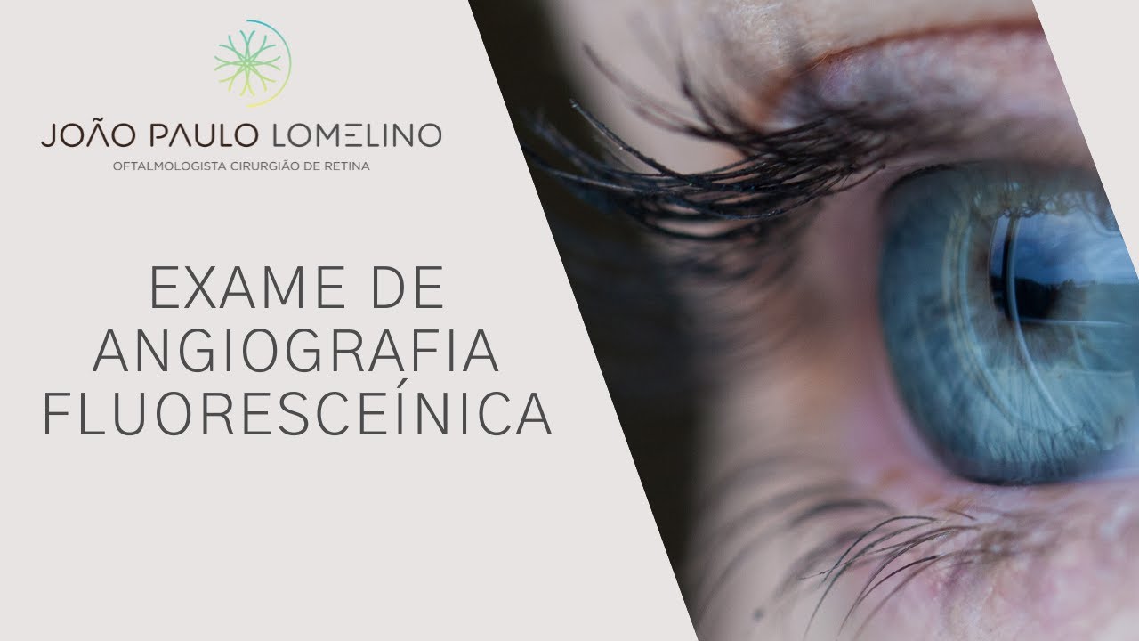 Exame de Angiografia fluoresceínica | Dr. João Paulo Lomelino