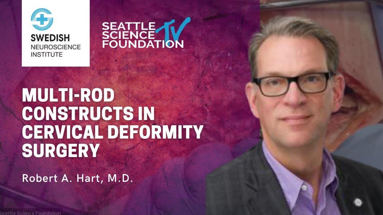 Multi Rod Constructs in Cervical Deformity Surgery- Robert A  Hart, M.D.