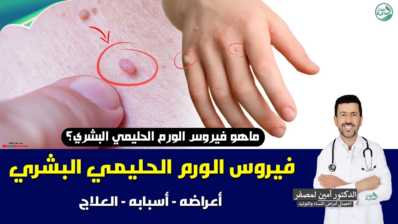 ما هو فيروس الورم الحليمي البشري ؟ | د. أمين لمصفر أخصائي أمراض النساء والتوليد