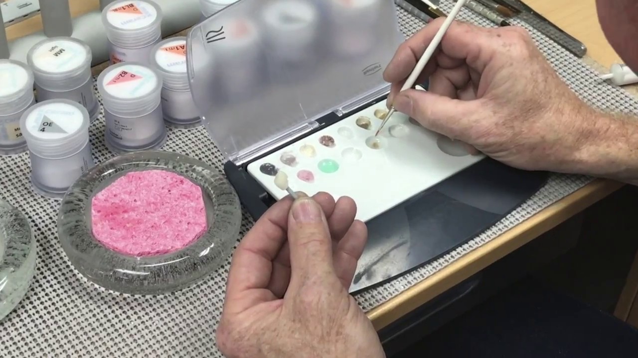 Custom Staining Tips for the Chair Side emax Crown