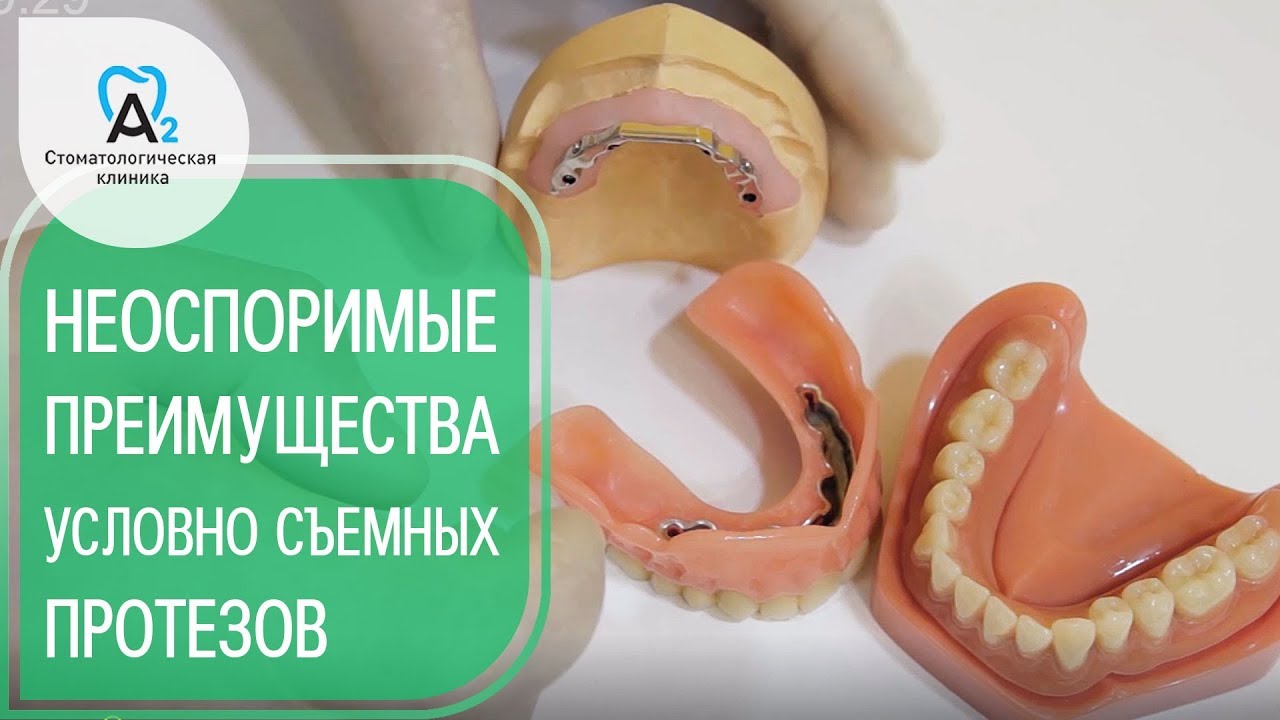 Протезы на имплантах. 😀 Почему стоит выбрать  условно съемные протезы на имплантах. 12+