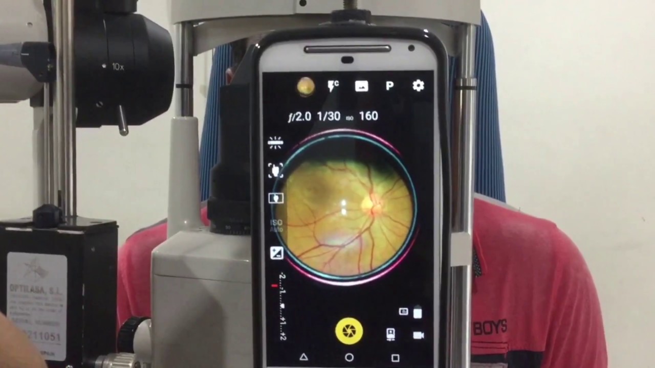 Jaiz RetiCAM - Smartphone Retinal Imaging