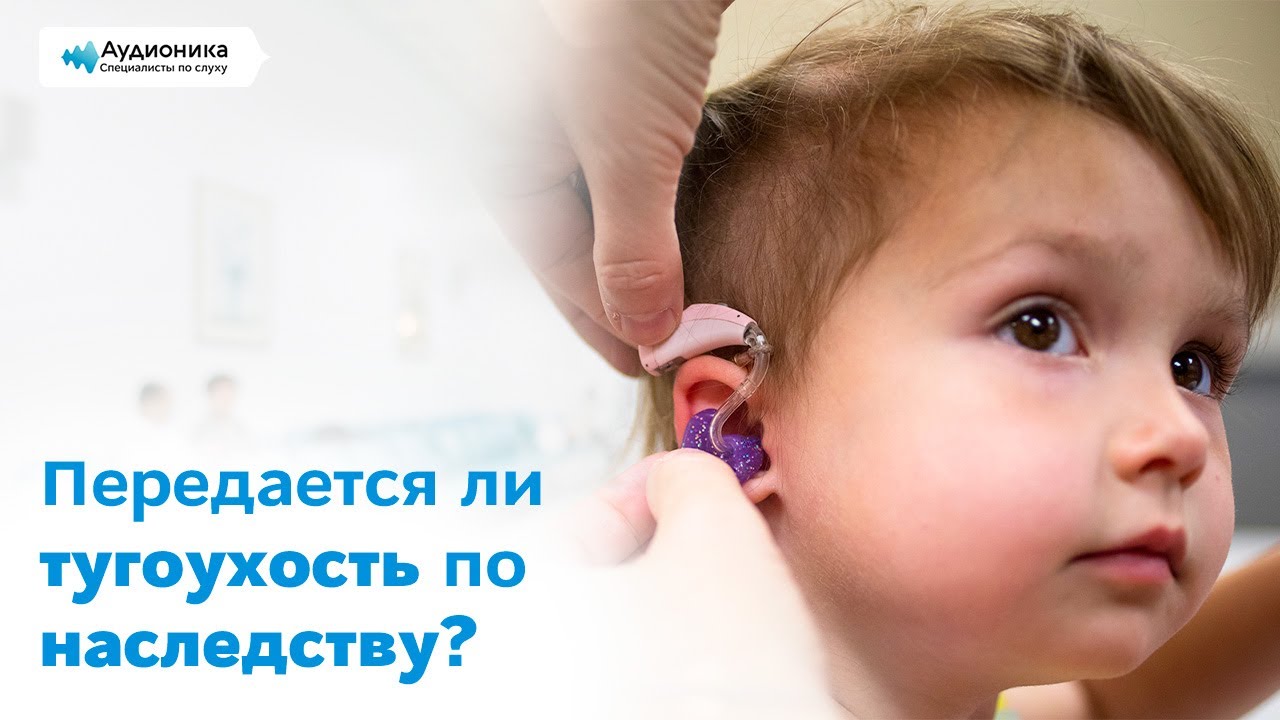 Передается ли тугоухость по наследству