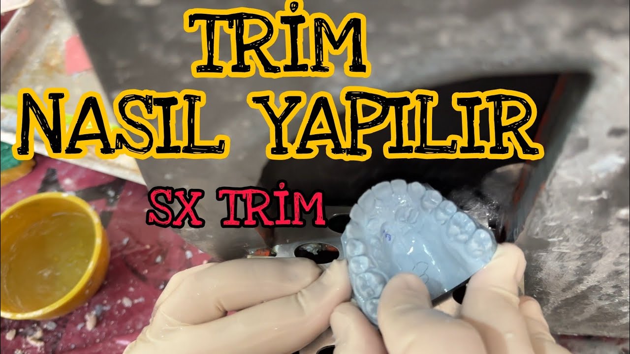 Trim Nasıl Yapılır Ortodontik Trim SX Trim