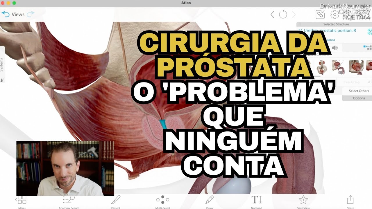 Cirurgia da Próstata: O Problema Que Ninguém Te Conta