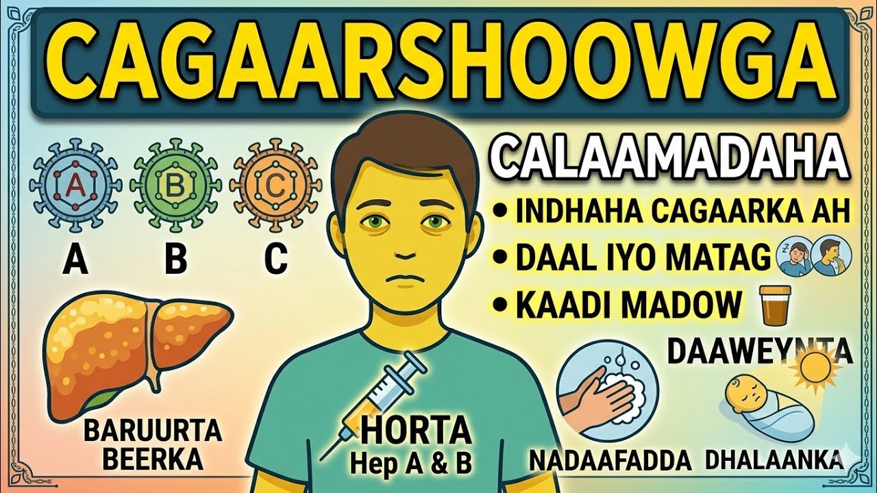 Hadii aad tahay shaqqale caafimaad talaalka cagaarshoowga qaado