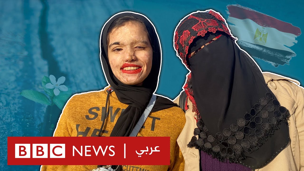 الحرق بالحمض: هكذا نجوت أنا وابنتي من الرش بالأسيد