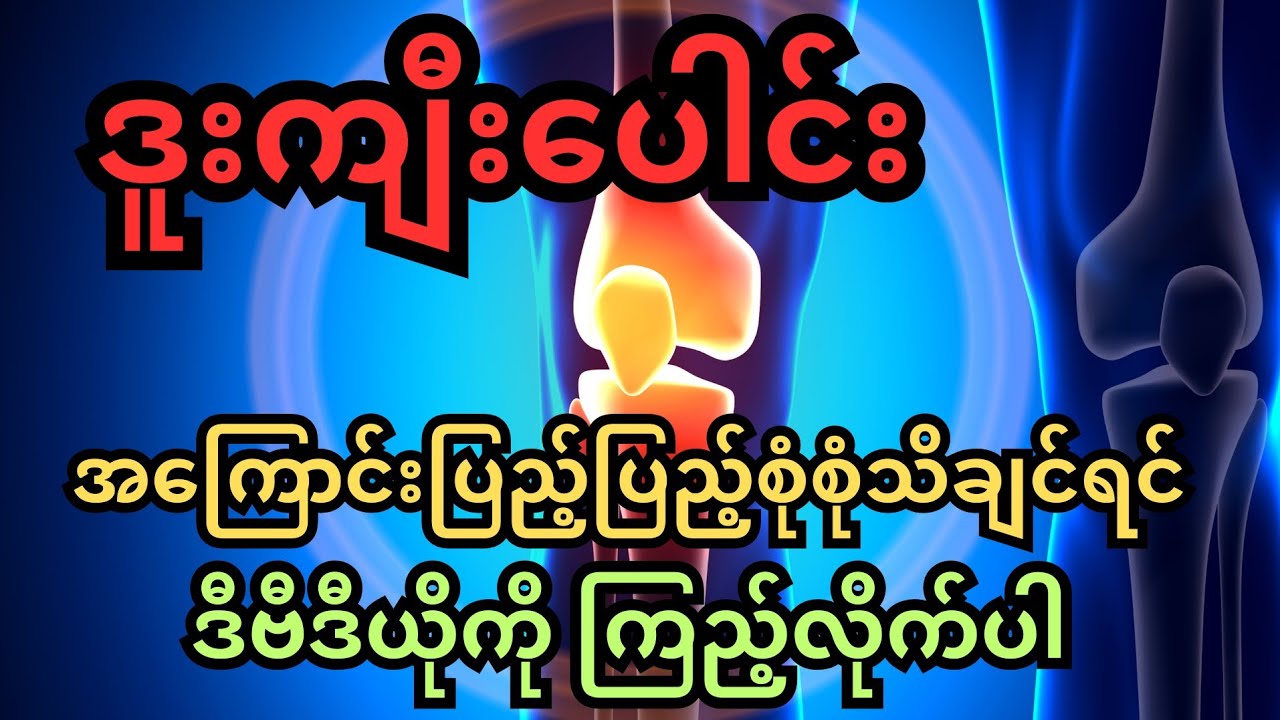 ဒူးကျီးပေါင်းအကြောင်းပြည့်ပြည့်စုံစုံသိချင်ရင် ဒီဗီဒီယိုကိုကြည့်ပါ - knee pain