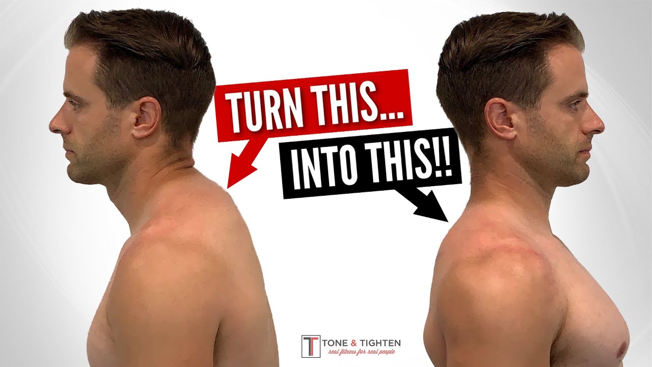 Fix Neck Hump FAST With These Home Exercises!