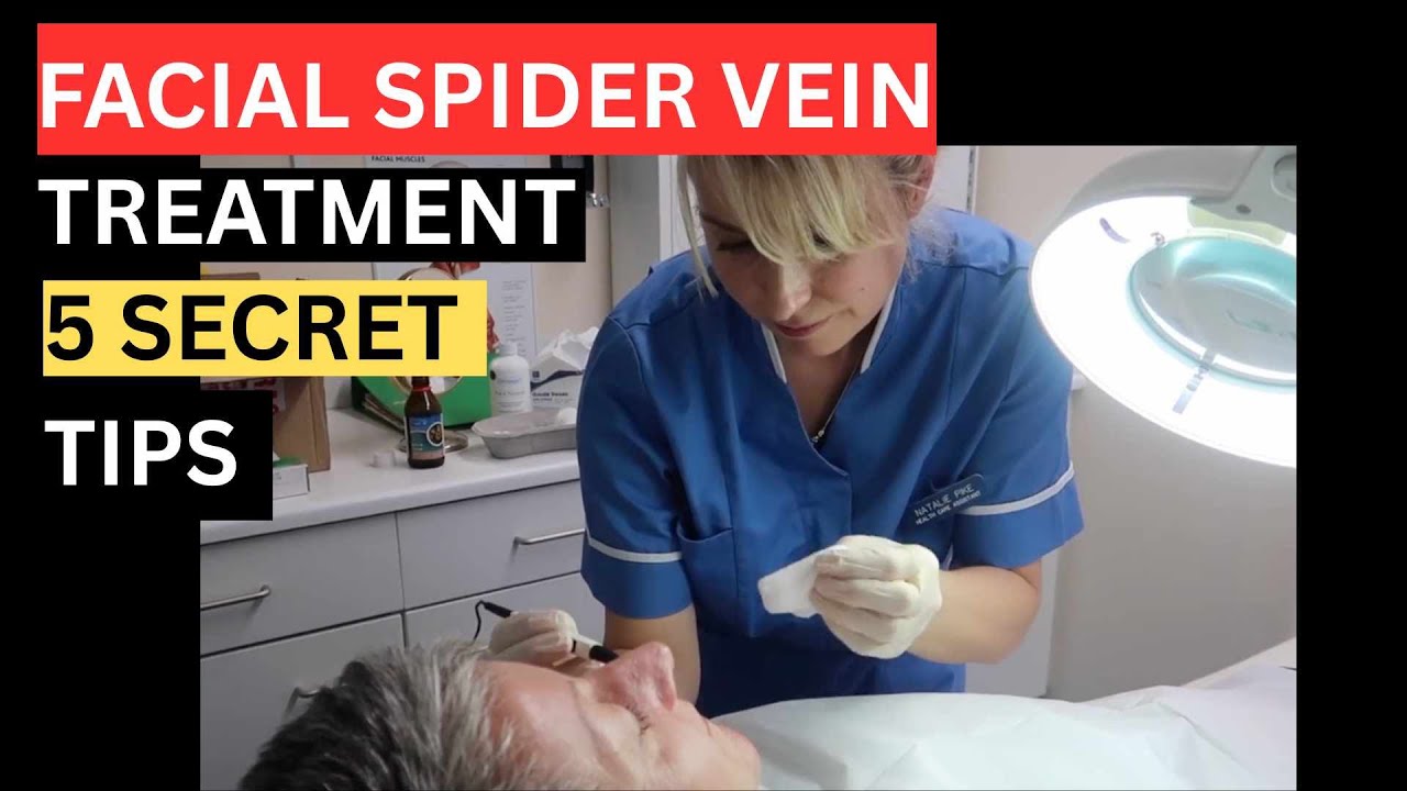 Facial Vein Removal: 5 Short Wave Diathermy Secrets - Electrocoagulation, RF etc - 98% Success Rate!