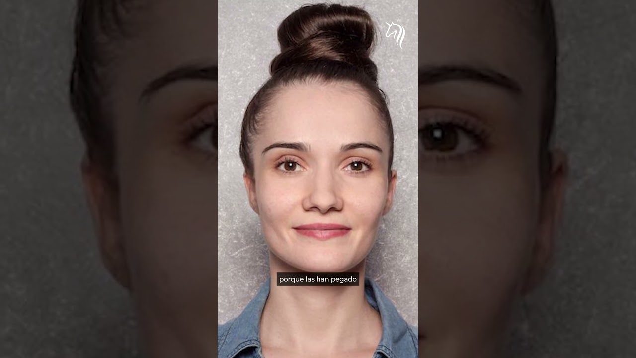 Todo sobre la Otoplastia | Ideal Plastic Surgery