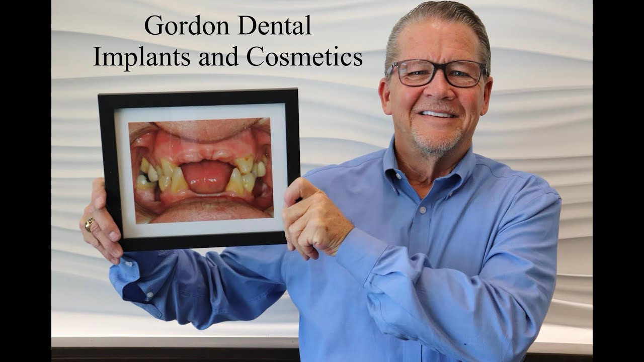 Full Mouth Dental Implants in Kansas City MO: Patient Reviews and Testimonials for Gordon Dental
