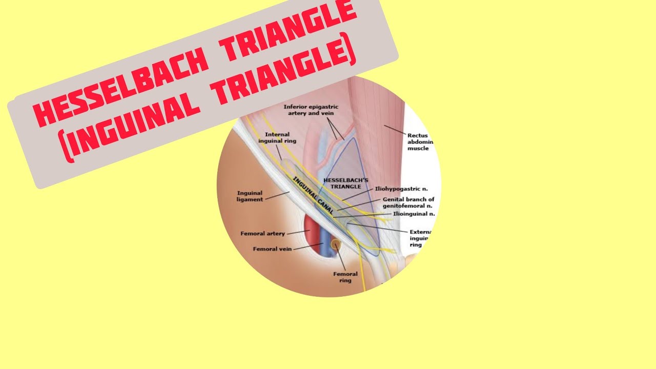 Hesselbach Triangle (Inguinal triangle)