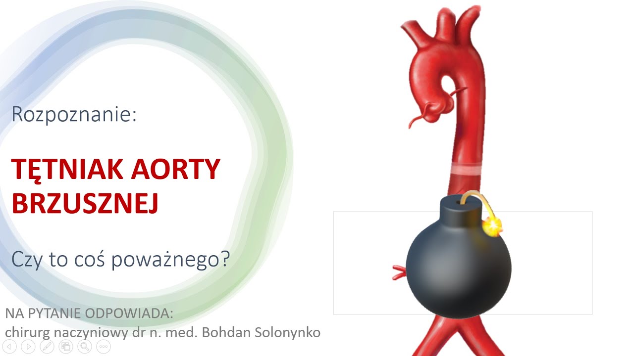 TĘTNIAK AORTY BRZUSZNEJ - CZY TO COŚ POWAŻNEGO?#TĘTNIAKAORTY #AORTA