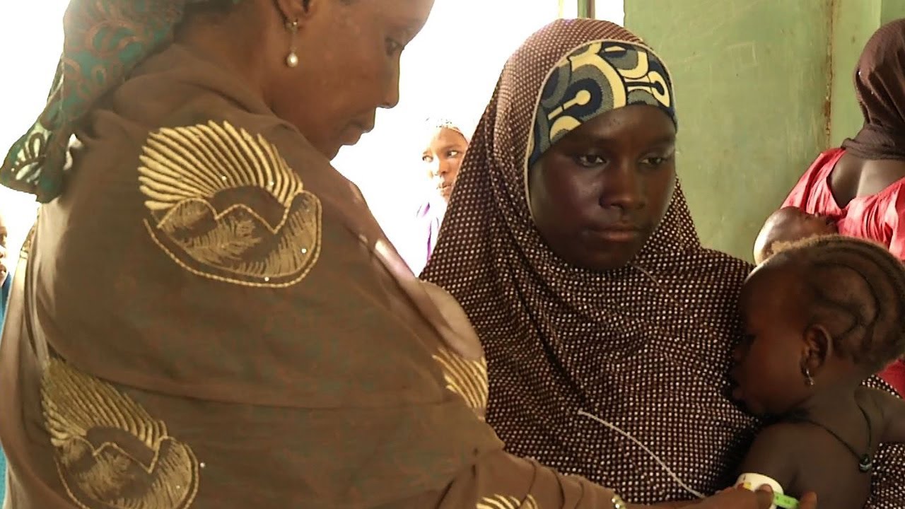 Outpatient treatment for severe child malnutrition in Nigeria