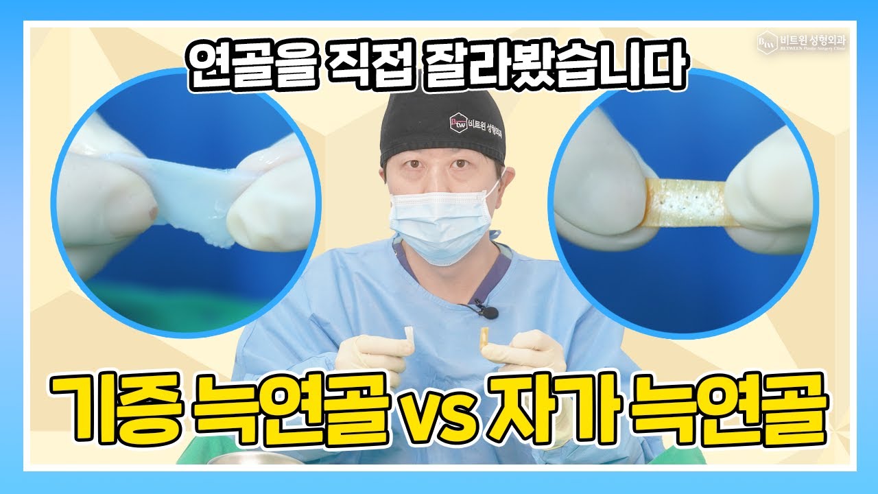 기증 늑연골 vs 자가 늑연골, 실제 차이 보여드립니다!🦴 직접 커팅까지 | 비트윈성형외과