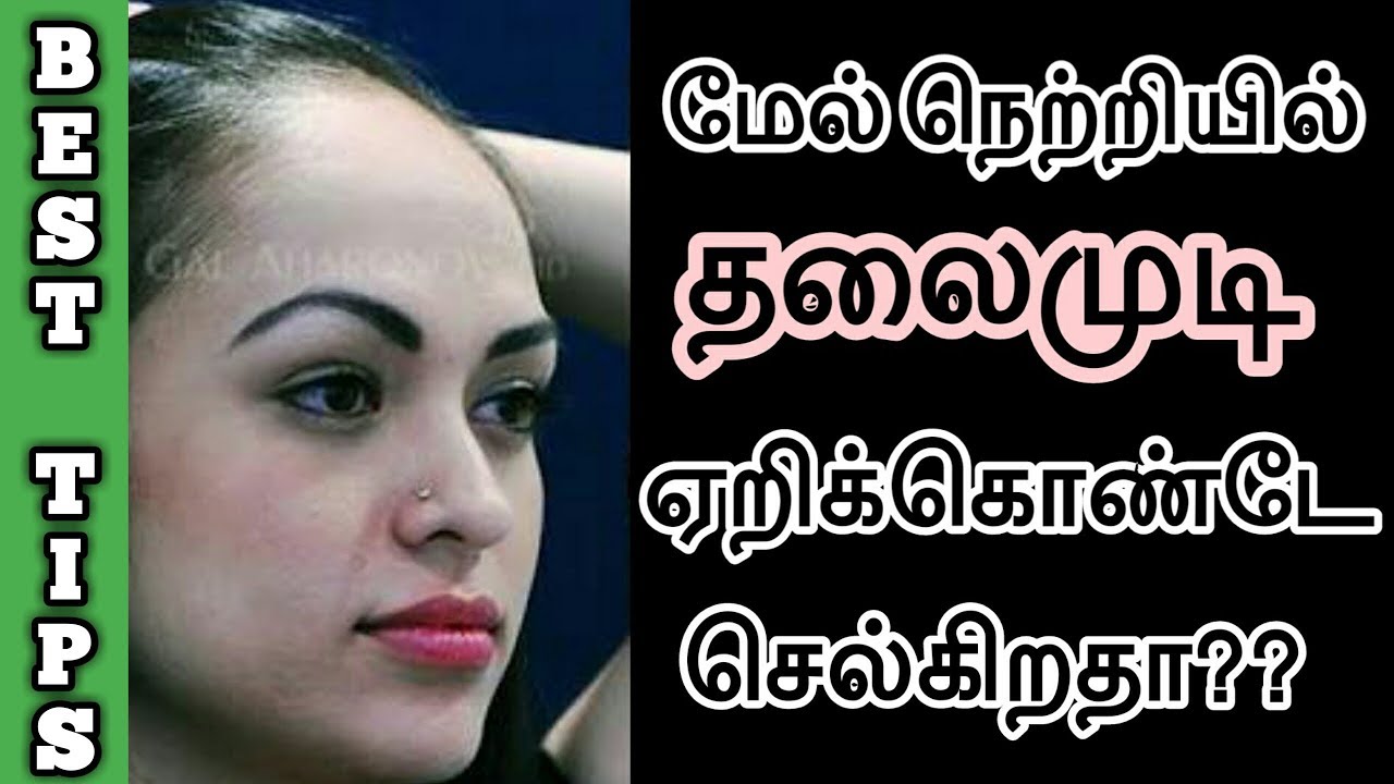 மேல் நெற்றியில் தலைமுடி ஏறிக்கொண்டே செல்கிறதா | Hair growth tips for forehead in Tamil