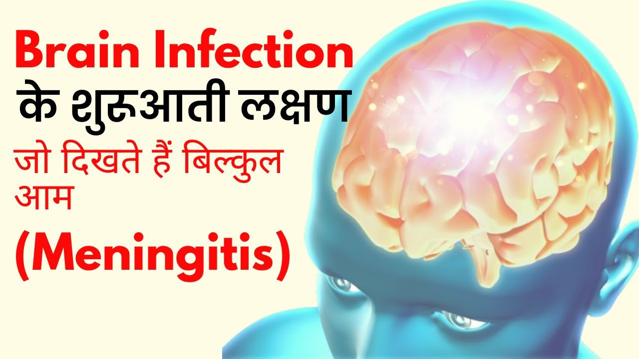 दिमाग का इंफेक्शन (Meningitis) को ऐसे पहचानें I  Meningitis से बचने के उपाय I Dr. Nitin Saluja
