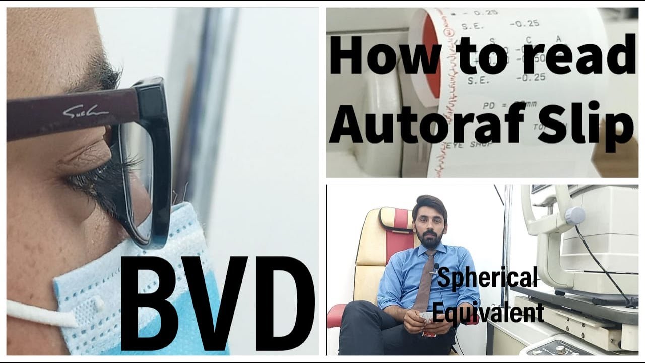 How to read Auref Slip, Spherical Equivalent, Back vertex Distance