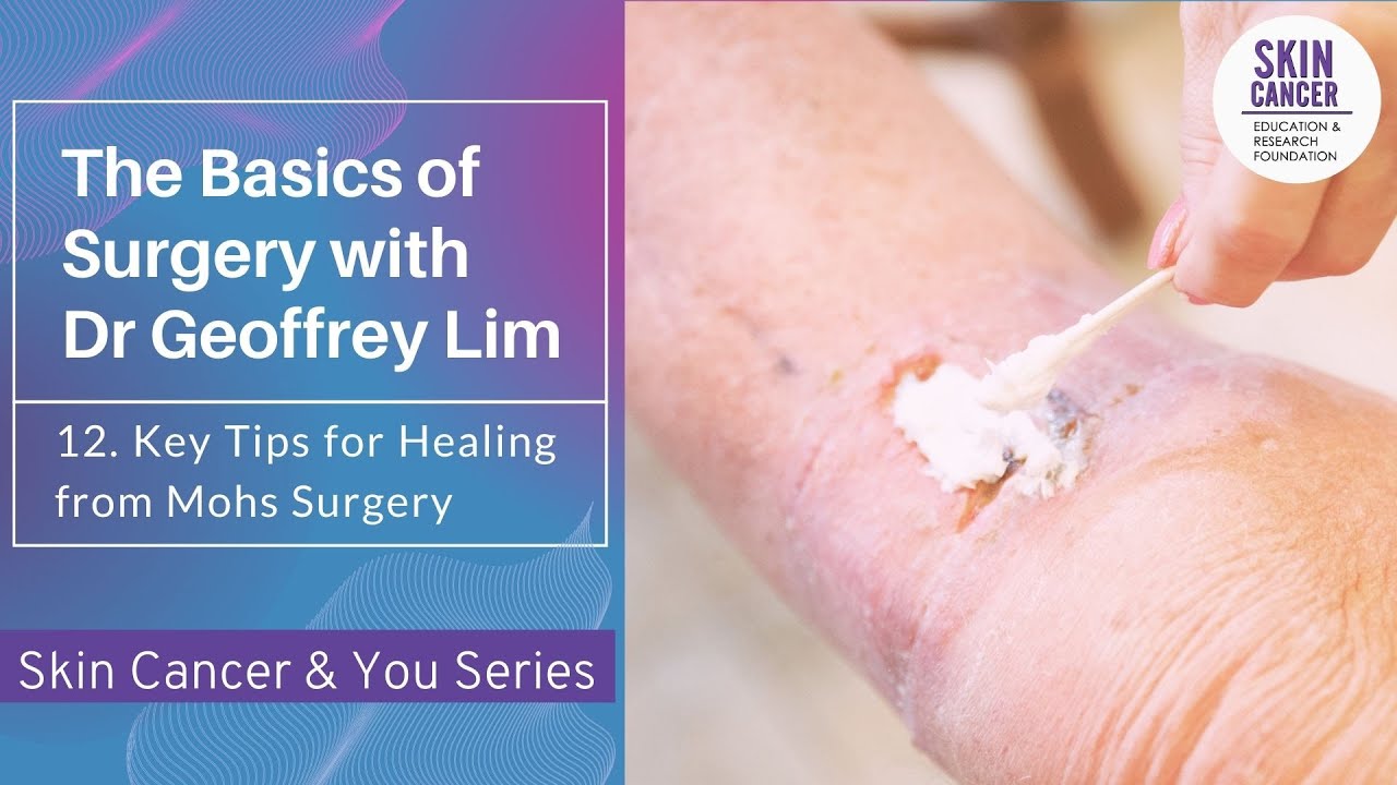 12. Key Tips for Healing from Mohs Surgery: Basics of Surgery with Geoffrey Lim