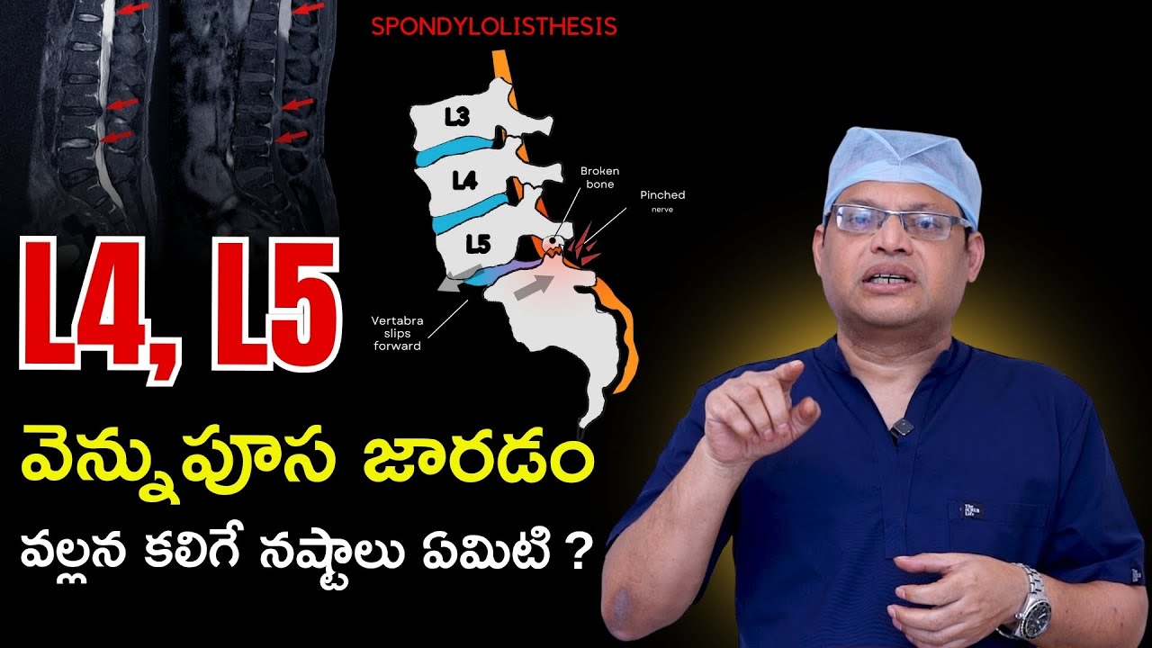 L4 L5, వెన్నుపూస జారడం వల్లన కలిగే నష్టాలు | L4 L5 | Spondylolisthesis in telugu | Dr GPV Subbaiah
