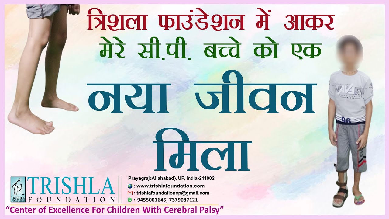 How to Treat Spastic Hemiplegic Cerebral Palsy Kid by Planned CP Treatment & Therapy [Hindi]