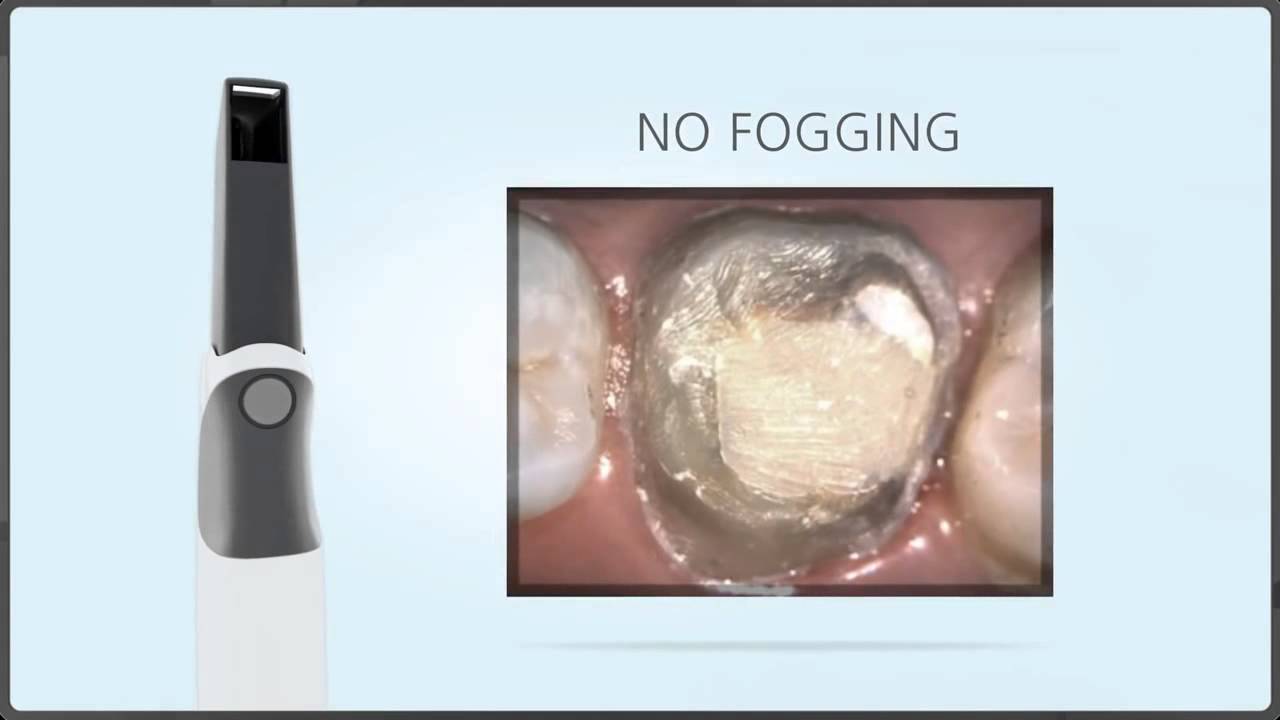 CS 3500 Intraoral Scanner