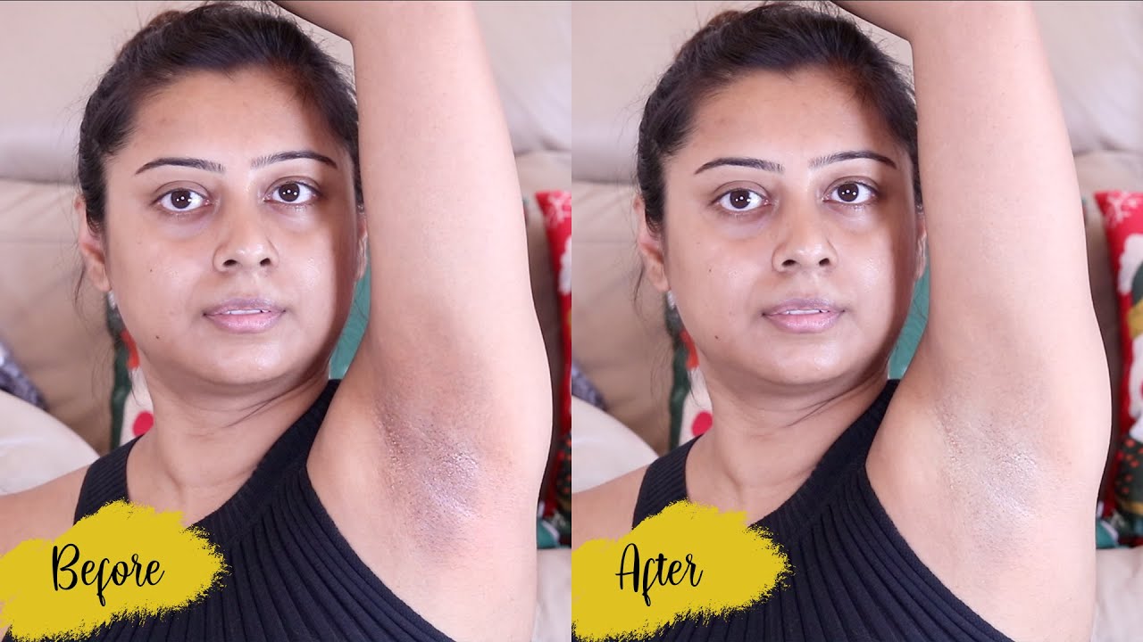 Underarm Whitening LIVE EXPERIMENT - INSTANT RESULT