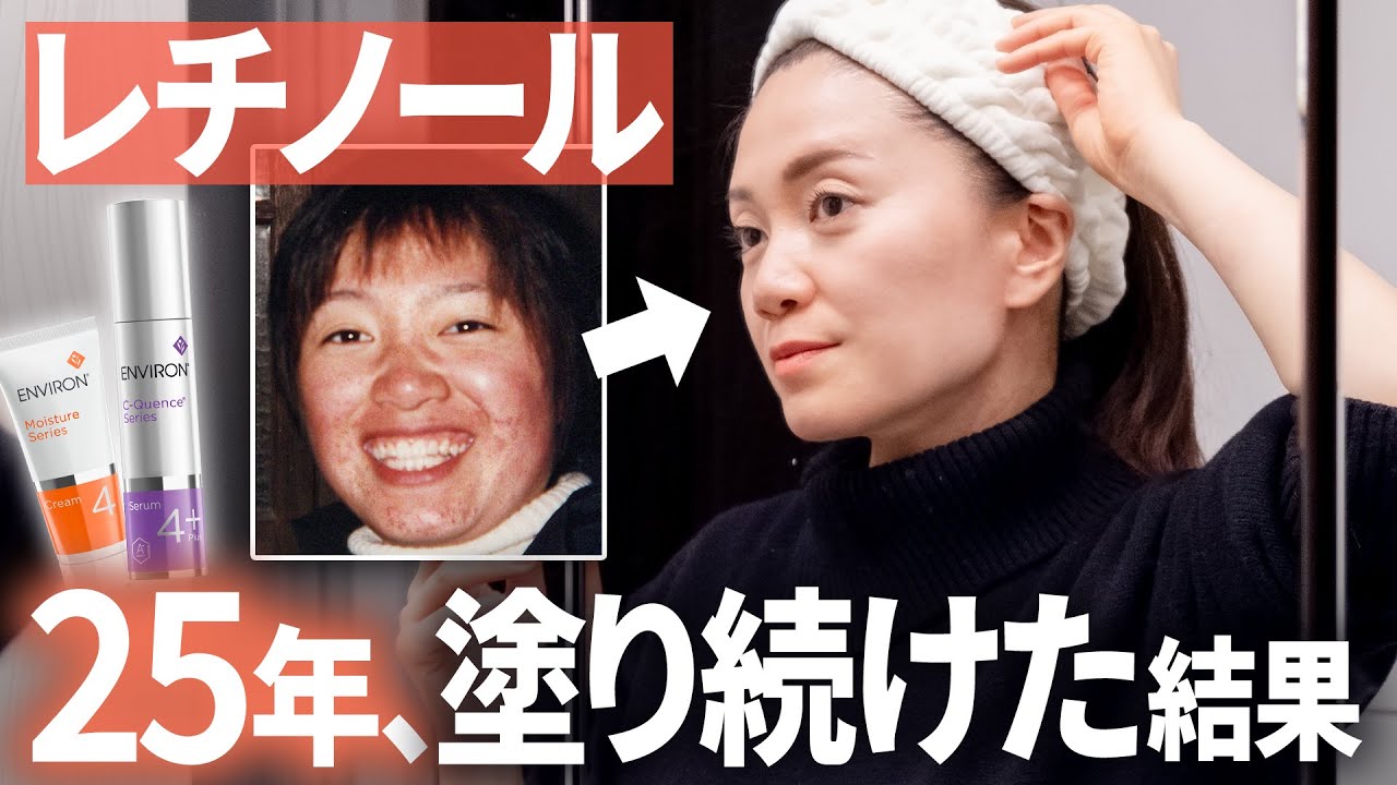 【実話】レチノールを25年塗り続けたら... #uzuz美容ニュース