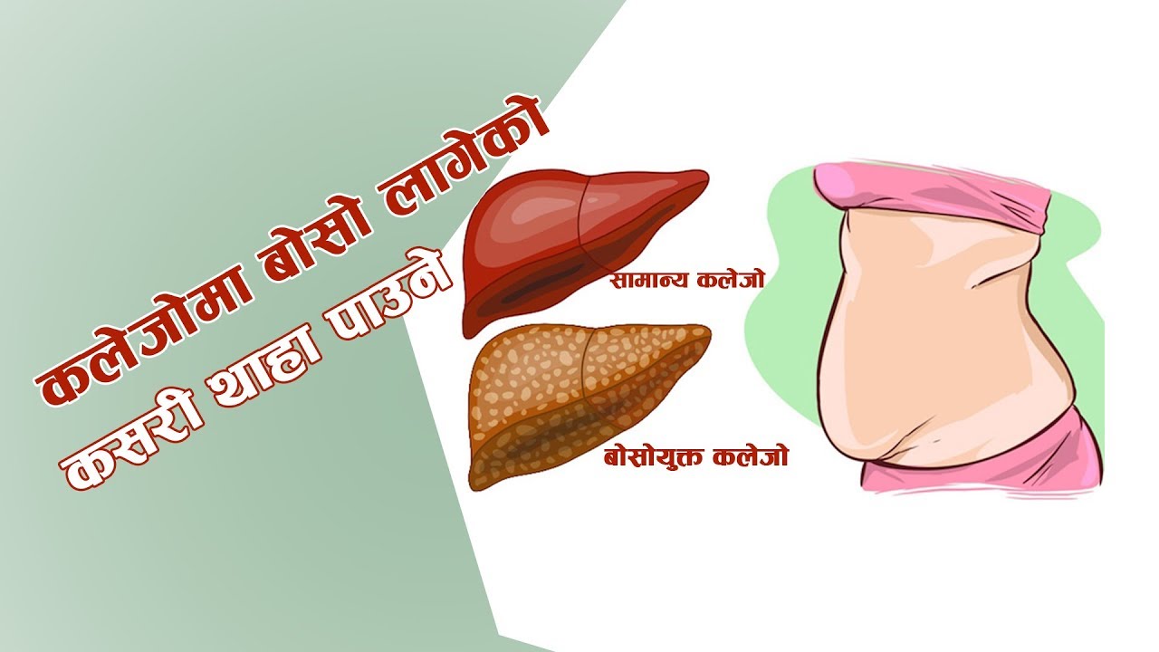 कलेजोमा बोसो जमे मटुमा समस्या - Dr. Hom Pun | Hamro Doctor