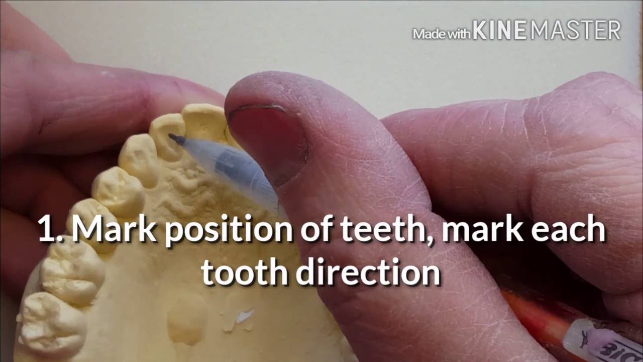 Ortho Spring Retainer lesson #1 of 4 (cutting out teeth)