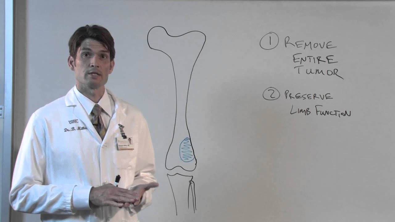Limb Salvage Surgery for Bone Sarcoma - Ben Miller, MD
