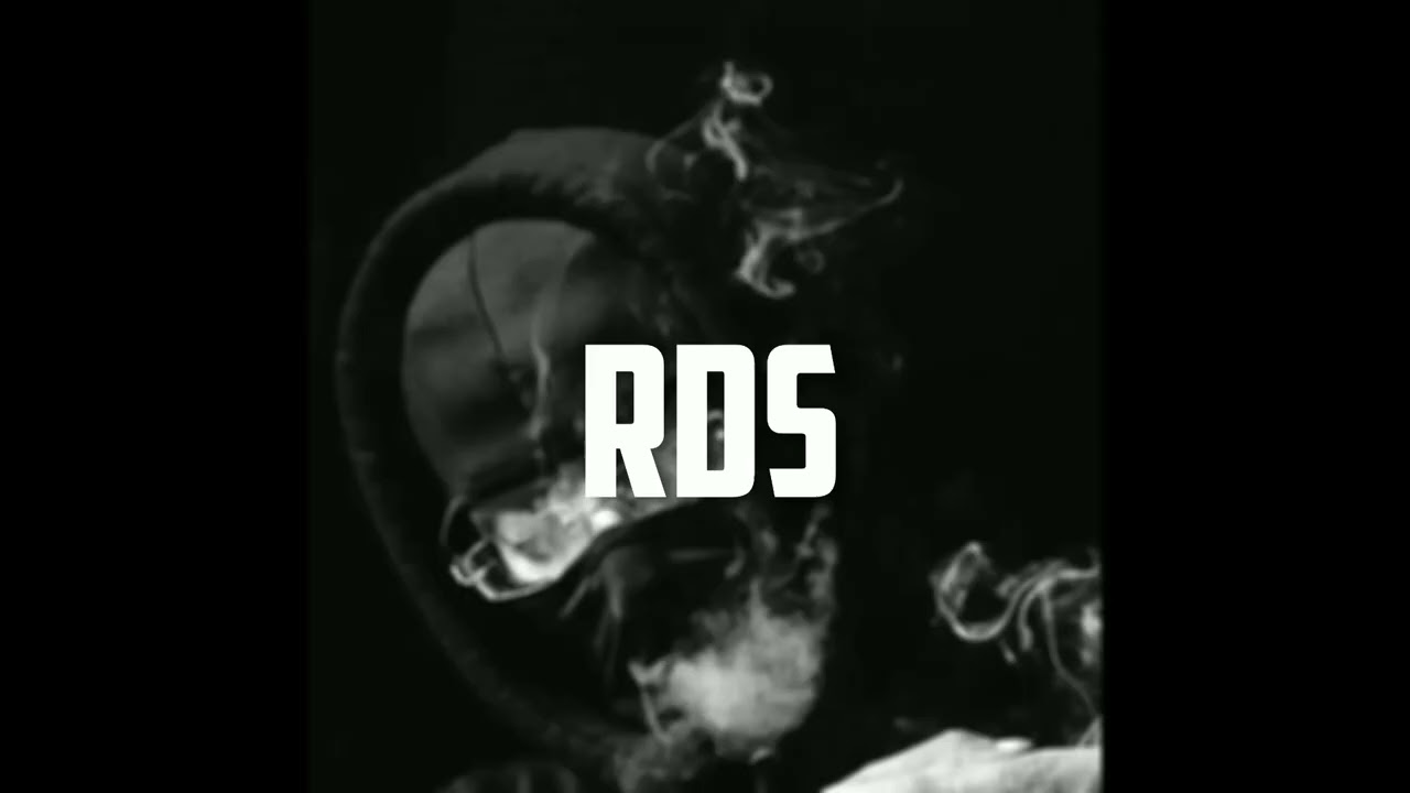 FREE FREEZE CORLEONE TYPE BEAT - RDS