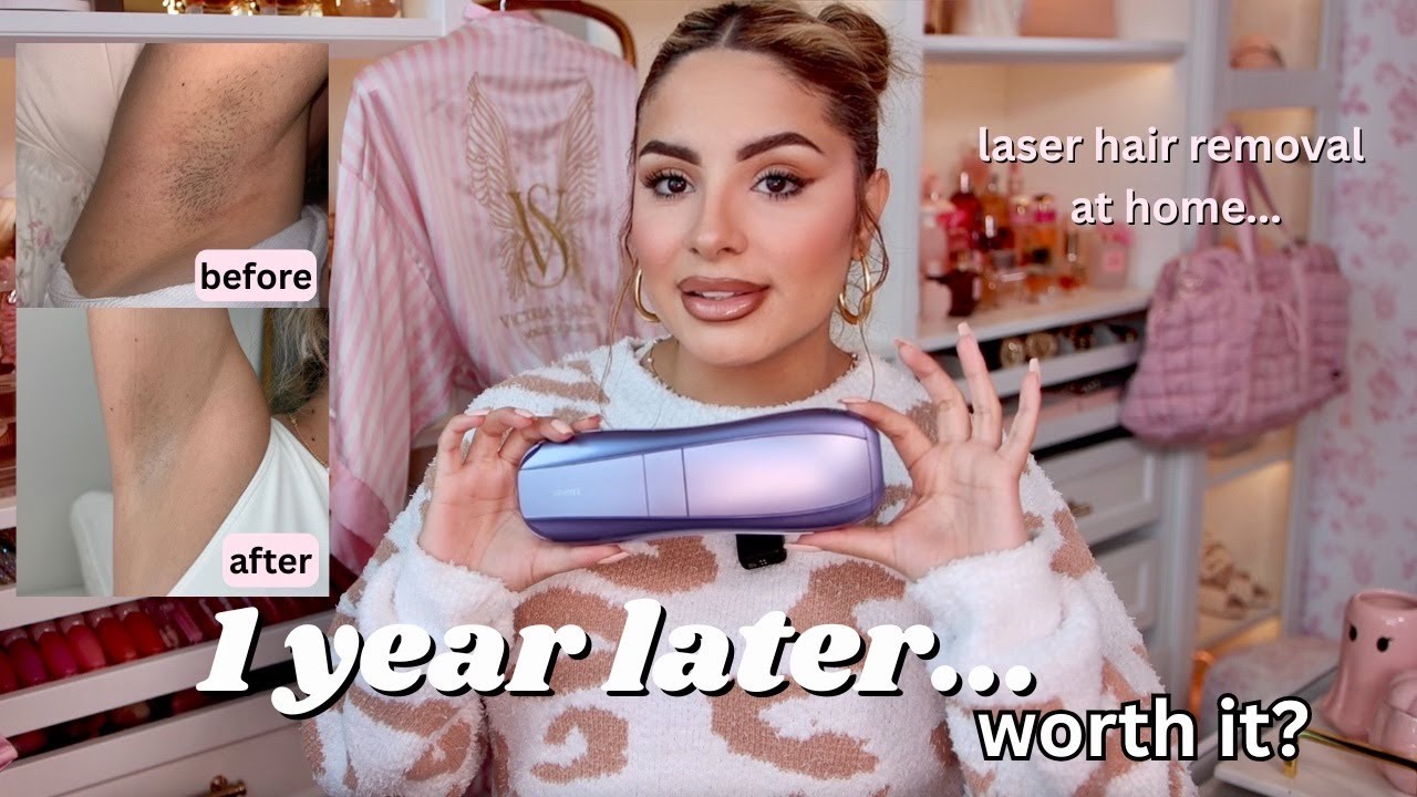 What Happened After 1 Year of At-Home Laser Hair Removal (REAL RESULTS!)